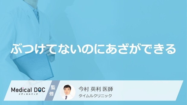 「ぶつけてないのにあざができる」原因はご存知ですか？医師が徹底解説！