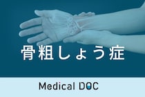 初期は症状のない｢骨粗しょう症｣ どこで診断･治療できる? 医師が必要な検査･治療法を解説