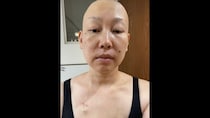 【闘病】『乳がん』宣告と終わらない治療の日々… 一児の母が痛感した健康と備えの後悔