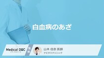 「白血病」で起きる”3つの特徴的なあざ”はご存じですか？医師が解説！