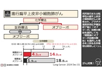 「肺がん」治療の有効性、新たな可能性が研究で明らかに《進行期扁平上皮非小細胞がん》