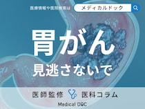 初期症状がない「胃がん」を早く見つける方法はご存じですか? 胃がん検診の流れや注意点も医師が解説