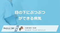 「目の下にぶつぶつ」で考えられる”7つの病気”はご存じですか？医師が解説！