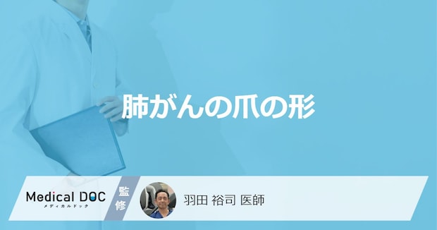 「爪の形」がどのように変化したら「肺がん」を疑った方がいい？3つの特徴を医師が解説！