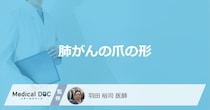 「爪の形」がどのように変化したら「肺がん」を疑った方がいい？3つの特徴を医師が解説！