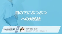 「目の下のぶつぶつ」の対処法はご存じですか？効果的な市販薬も医師が解説！