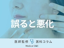 シミは部位ごとに原因が違うって本当？ それぞれのケア方法を医師に聞く