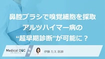 「鼻からブラシを入れてにおい（嗅覚）細胞を採取」でアルツハイマー病の“超早期診断”が可能に？
