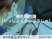 「褐色細胞腫」とは？症状・治療法・原因・検査についても解説！医師が監修！