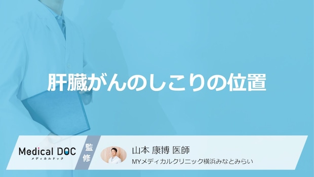 「肝臓がん」を発症すると「しこり」はどの位置にできるかご存知ですか？【医師監修】