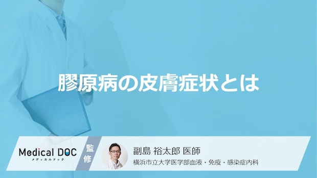 「膠原病」を発症すると「皮膚」にどんな症状が現れるかご存知ですか？【医師監修】