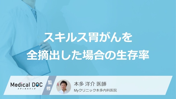 「スキルス胃がん」を”全摘出した場合の生存率”はご存じですか?医師が解説!