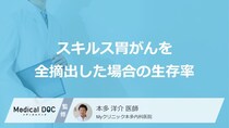 「スキルス胃がん」を”全摘出した場合の生存率”はご存じですか？医師が解説！