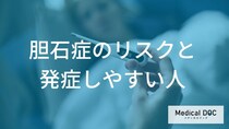 「胆石症」になりやすい人は3つの違いがある？ 女性に多い原因と症状【医師監修】