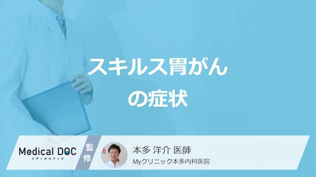 早期発見が難しい「スキルス胃がん」の初期症状はご存じですか？医師が解説！