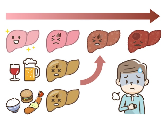 メタボリック肝硬変のメカニズム