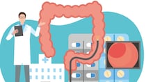 「大腸カメラ」は何歳から？ 『血便』や『腹痛』前に行うべき理由【医師解説】