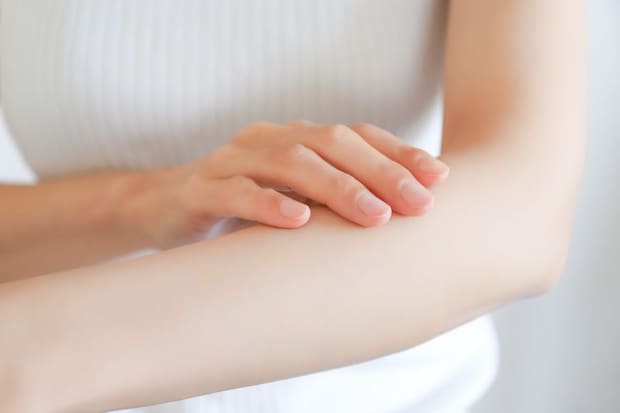 全身性エリテマトーデス|皮膚症状の特徴
