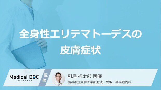 「全身性エリテマトーデス」を発症すると「皮膚」にどんな症状が現れるかご存知ですか?