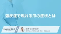 「強皮症」を発症すると「爪」にどんな症状が現れるかご存知ですか？【医師監修】