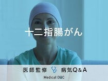「十二指腸がん」を疑う症状・原因はご存知ですか？ステージについても解説！