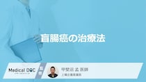 「盲腸癌」で”初期段階で行う治療”は何かご存知ですか？他の治療法も医師が解説！