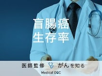 「盲腸癌の生存率」はご存知ですか？検査・治療法も解説！【医師監修】