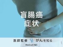 「盲腸癌の症状」はご存知ですか？原因や末期症状も解説！【医師監修】