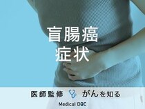 「盲腸癌の症状」はご存知ですか？原因や末期症状も解説！【医師監修】