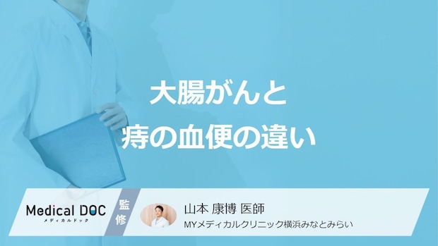 「大腸がんと痔の血便の違い」はご存知ですか?医師が監修!