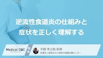 「逆流性食道炎」になりやすい人の特徴をご存じですか？ 見逃せない“3つの初期症状”【医師が解説】