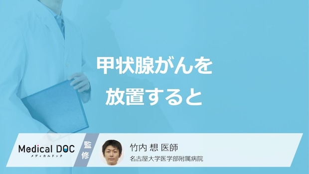「甲状腺がんを放置する」とどうなるかご存知ですか？種類も医師が解説！