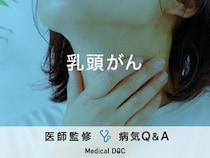 「乳頭がん」を発症すると現れる症状・原因はご存知ですか？ステージについても解説！