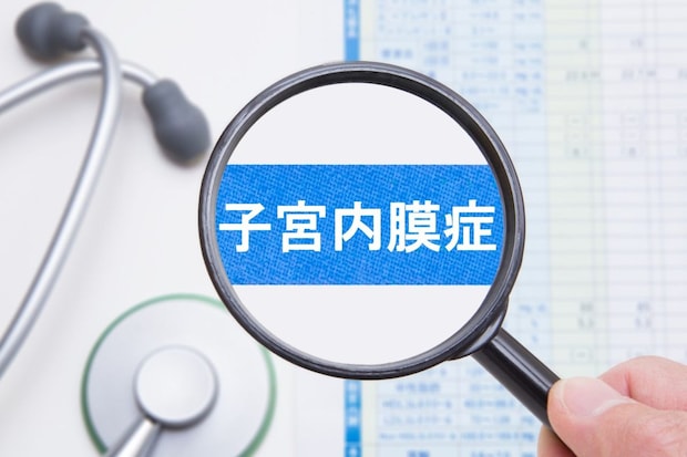 子宮内膜症とはどんな病気