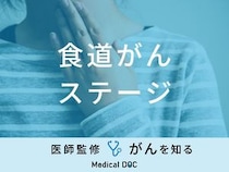 「食道がんのステージ別の症状」はご存知ですか？生存率も医師が徹底解説！