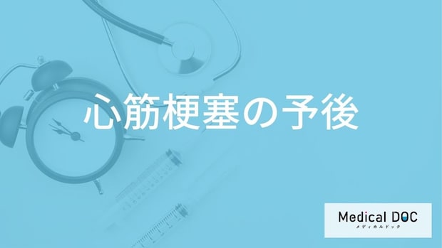 「心筋梗塞の予後」で”5年生存率が約何割”かご存じですか？予防法も医師が解説！