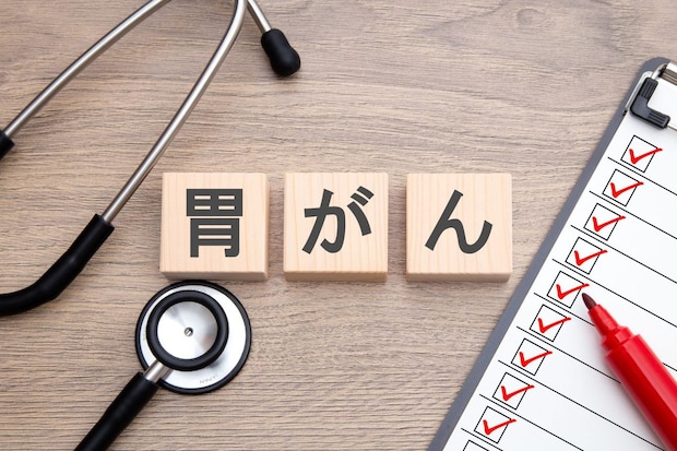 慢性胃炎が胃がんになるときの前兆や症状は？
