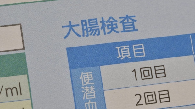 便潜血検査が陰性でも要注意？ 『下痢』や『腹痛』が示す危険なサインとは【医師監修】