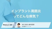 「インプラント周囲炎」ってどんな病気？ 歯周病との違いやリスク【医師解説】