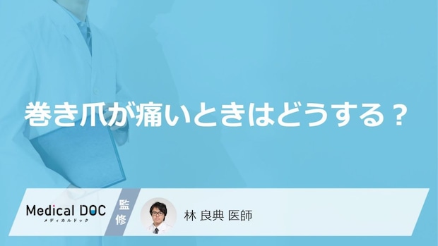 「巻き爪が痛くなる」のはどうして?痛くなった時の対処法も解説!【医師監修】