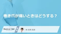 「巻き爪が痛くなる」のはどうして？痛くなった時の対処法も解説！【医師監修】