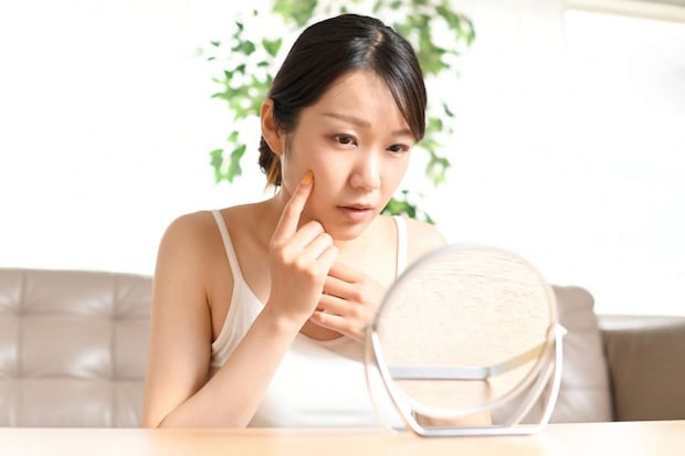 膠原病が疑われる症状と受診の目安