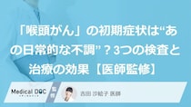 「喉頭がん」の初期症状は“あの日常的な不調”？3つの検査と治療の効果【医師監修】