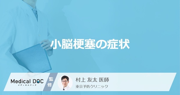 「小脳梗塞の症状」はご存知ですか？医師が徹底解説！
