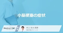 「小脳梗塞の症状」はご存知ですか？医師が徹底解説！