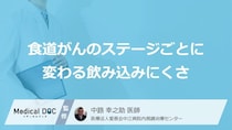 食事のときに水分が手放せなくなったら「食道がん」？見過ごせない体の変化【医師監修】