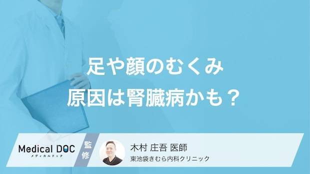 全身のむくみは「腎臓病」のサイン? 注意したいむくみの特徴を医師が解説!