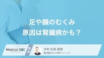 全身のむくみは「腎臓病」のサイン? 注意したいむくみの特徴を医師が解説!