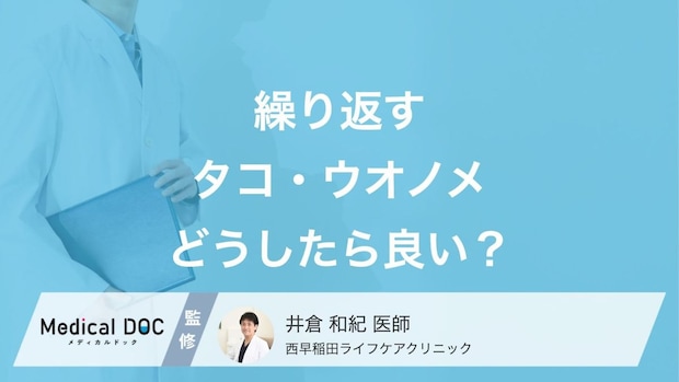 「タコ・ウオノメ」が繰り返しできる…どうしたらいい? 再発対策や予防法を医師が解説!