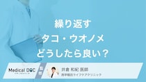 「タコ・ウオノメ」が繰り返しできる…どうしたらいい? 再発対策や予防法を医師が解説!
